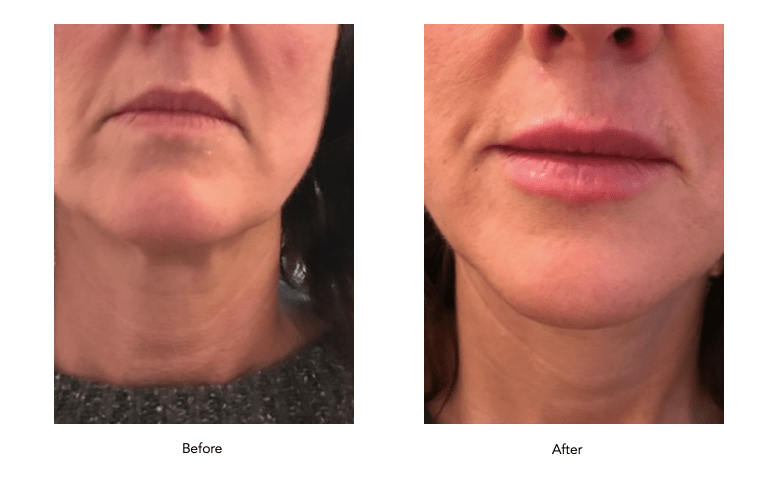 Screenshot 2020-04-02 at 15.08.44